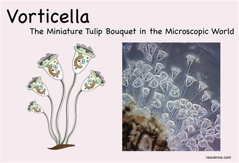  Vorticella! Un Piccolo Vortice di Vita Microscopica con Ciglia Vibranti